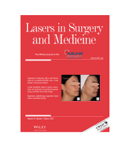 lasers in surgery and medicine-05
