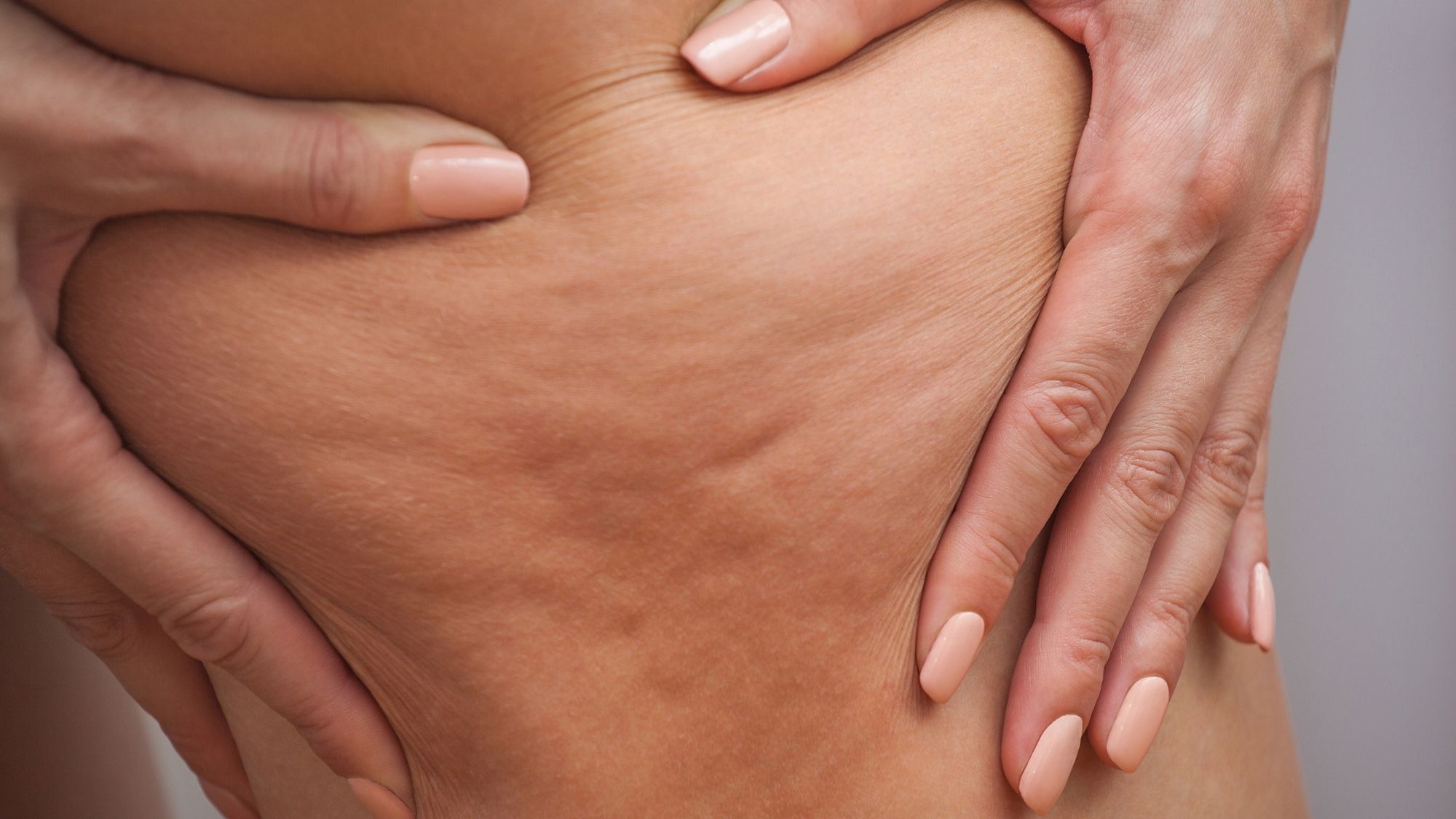 Say Goodbye to Cellulite on Your Bum: Effective Tips and Tricks