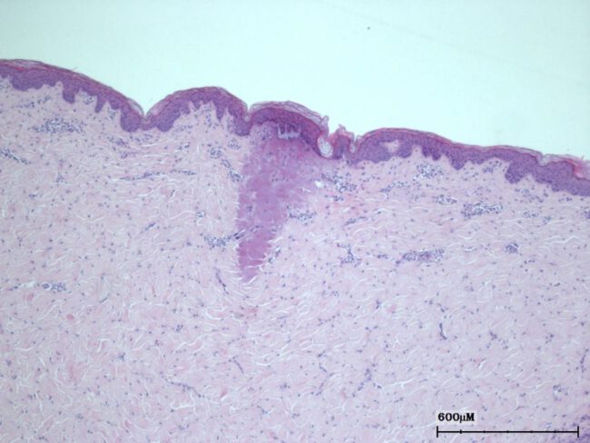 Histology Data on Porcine Skin