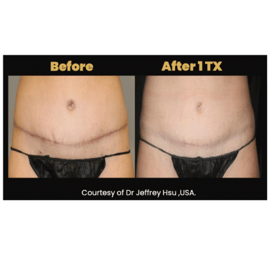 HSP70: A Key to Skin Resilience HSP70: A Key to Skin Resilience
