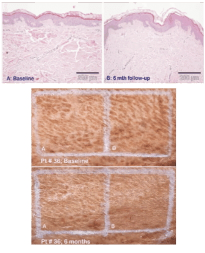 Dual-Wavelength Approach to Regeneration Dual-Wavelength Approach to Regeneration